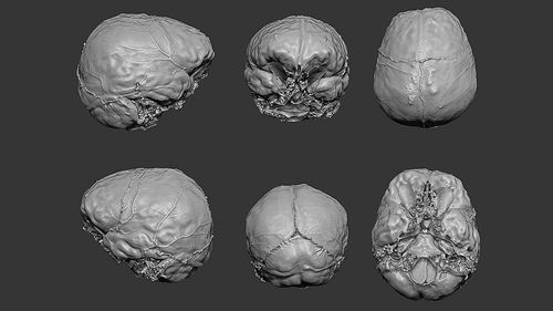 笛卡尔大脑3d模型 图片来源:c philippe等