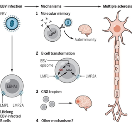 发现epstein-barr病毒会引发多发性硬化症--中国数字科技馆
