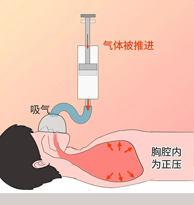 跑车厂;跨界;呼吸机