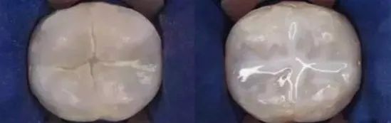 科学放大镜;宝爸宝妈;育儿;口腔卫生 科学放大镜;宝爸宝妈;育儿;口腔卫生