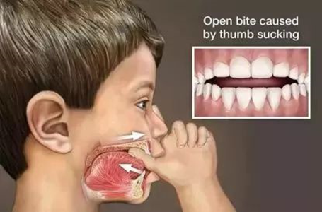 科学放大镜;宝爸宝妈;育儿;口腔卫生 科学放大镜;宝爸宝妈;育儿;口腔卫生