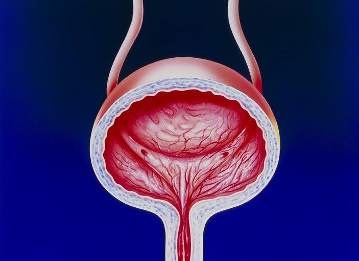 女性膀胱外面图片