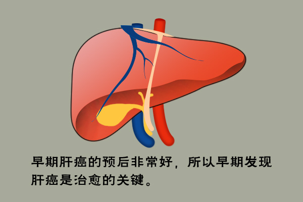 全国爱肝日;远离肝癌;怎么预防肝癌;