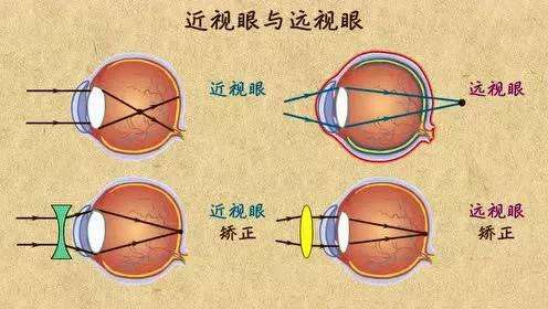 自动验光机;近视;远视 自动验光机;近视;远视