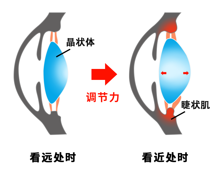 近视眼;视力 近视眼;视力