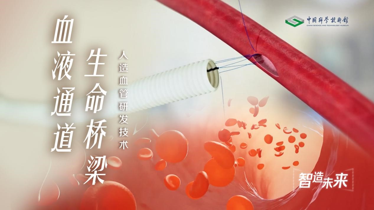 【智造未来】血液通道 生命桥梁——人造血管研发技术